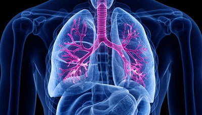 什么是慢性阻塞性肺病 (Chronic Obstructive Pulmonary Disease)，為何與新冠疫情有關？